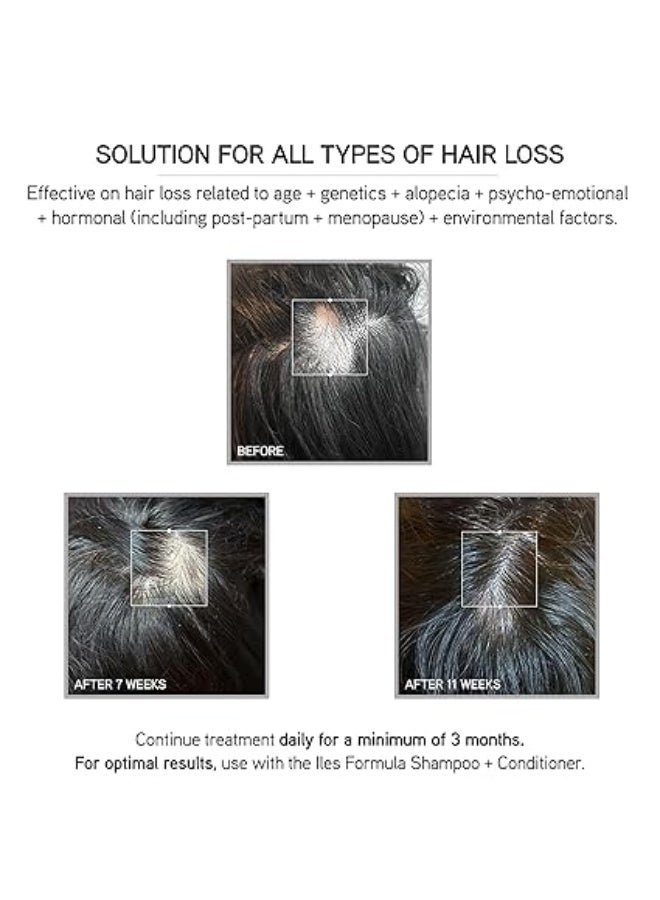 Iles Formula Scalp + Hair Rejuvenating Booster 50ml - Image 2